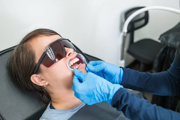 Best Emergency Dental Care for Broken or Chipped Teeth in San Gabriel, CA